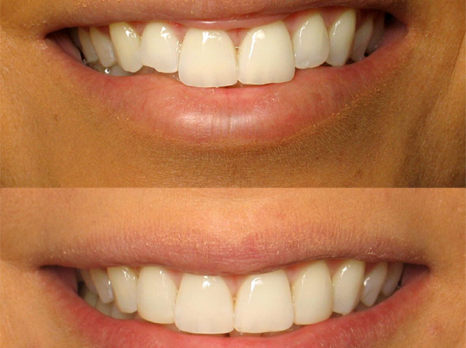 client 1