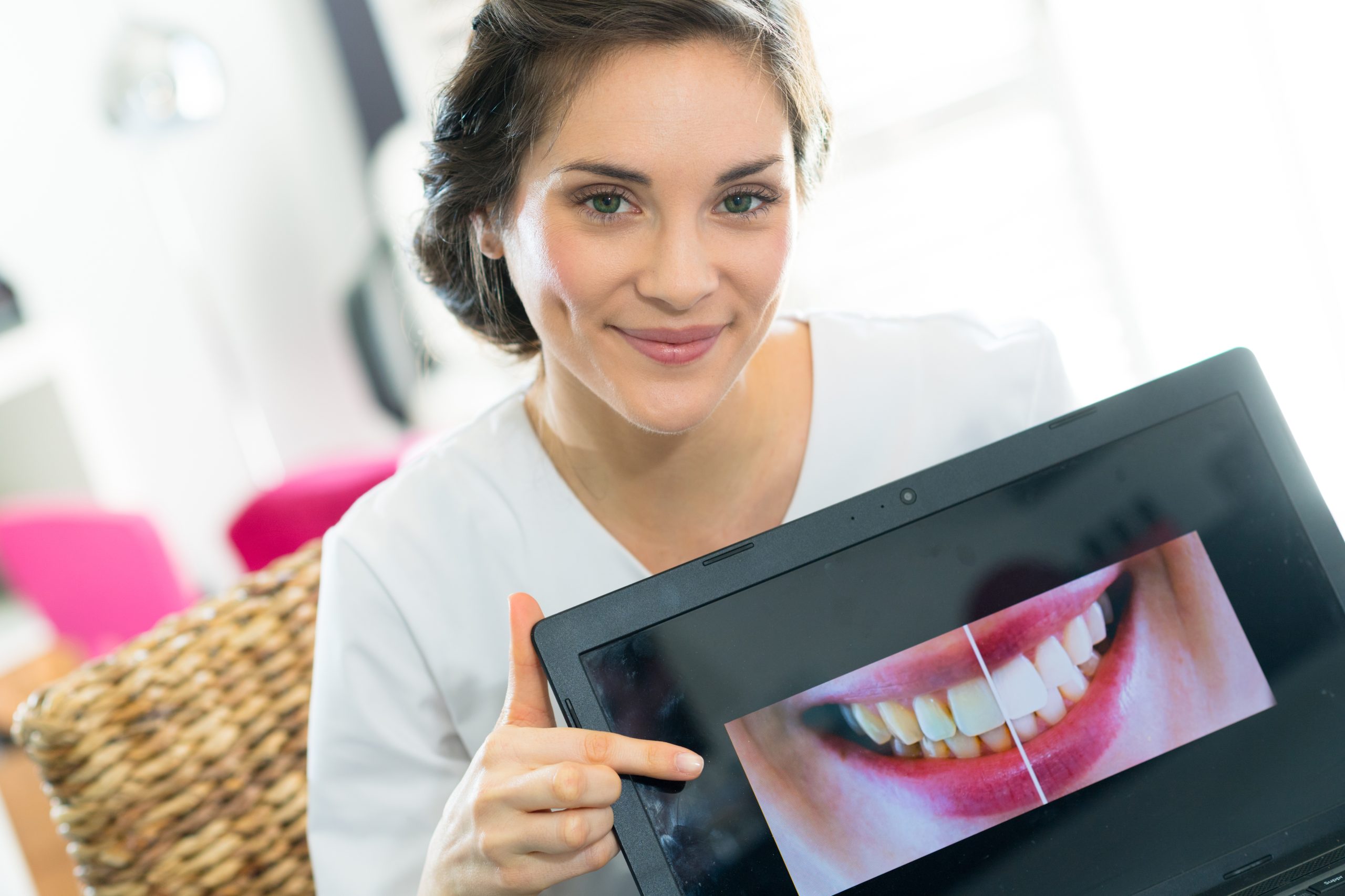 dental worker showing before and after teeth bleaching Woman pointing at a screen with a split screen image of a before and after smile